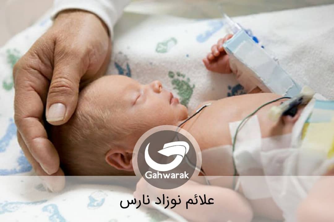 علائم نوزاد نارس چیست؟