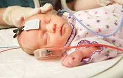 شیوع ناشنوایی مادر زادی در نوزادان