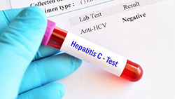 هپاتیت C در کودکان